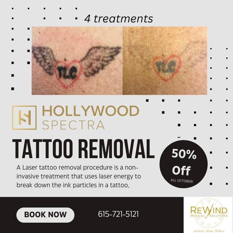 Instagram post from rewindmedicalsolutions. This post is in position 1.